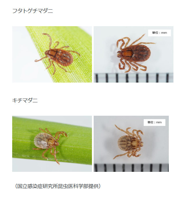 マダニに噛まれたら死ぬの？噛まれたら何科を受診？重症熱性血小板減少症候群とは？